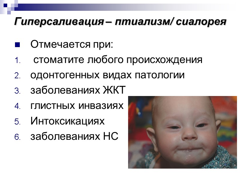 Гиперсаливация – птиализм/ сиалорея  Отмечается при:  стоматите любого происхождения одонтогенных видах патологии